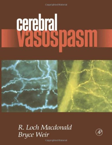 medical/neurology/cerebral-vasospasm-9780124641617