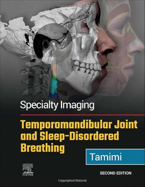 medical-reference-books//specialty-imaging-temporomandibular-joint-and-sleep-disordered-breathing-2nd-ed-9780323877480