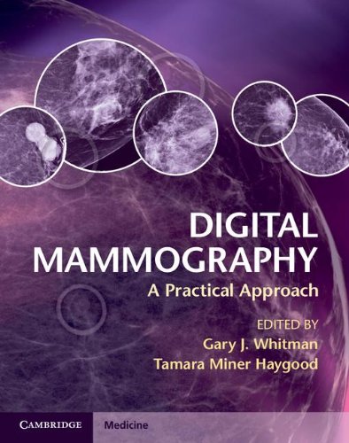medical/radiology/digital-mammography-9780521763721
