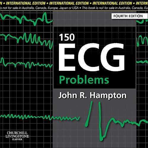 medical/cardiology/150-ecg-problems-9780702046711