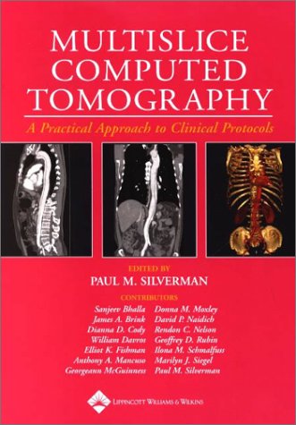MULTISLICE COMPUTED TOMOGRAPHY A PRACTICAL APPROACH TO CLINICAL PROTOCOLS medical/radiology/multislice-computed-tomography-a-practical-approach-to-clinical-protocols-9780781733120