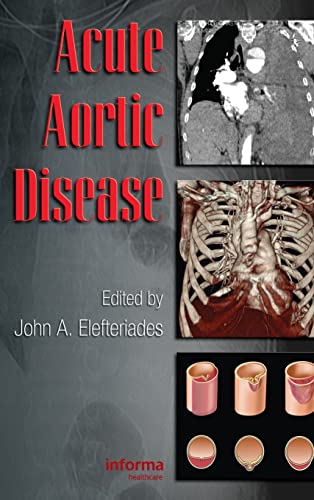 medical/cardiology/acute-aortic-diseases-1-ed-9780849370236