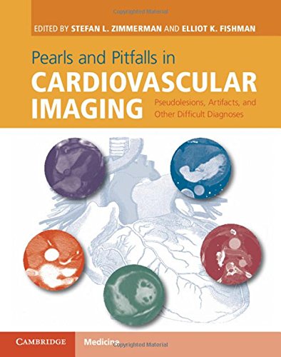 medical/cardiology/pearls-and-pitfalls-in-cardiovascular-imaging-pseudolesions-artifacts-and-other-difficult-diagnoses-9781107023727