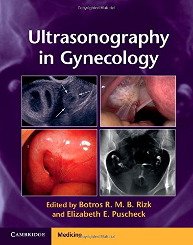 medical//ultrasonography-in-gynecology--9781107029743