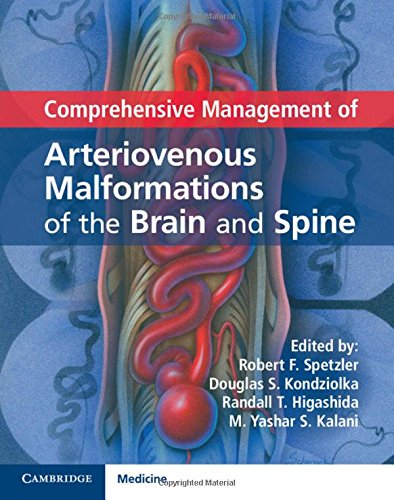 medical/neurology/comprehensive-management-of-arteriovenous-malformations-of-the-brain-and-spine-9781107033887