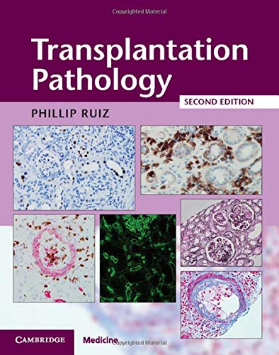 medical/pathology/transplantation-pathology-hardback-with-online-resource-9781107443280