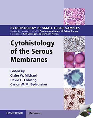 medical/pathology/cytohistology-of-the-serous-membranes-9781107539167