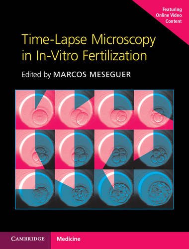 medical//timelapse-microscopy-in-invitro-fertilization-9781107593268
