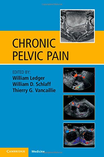 medical//chronic-pelvic-pain--9781107636620