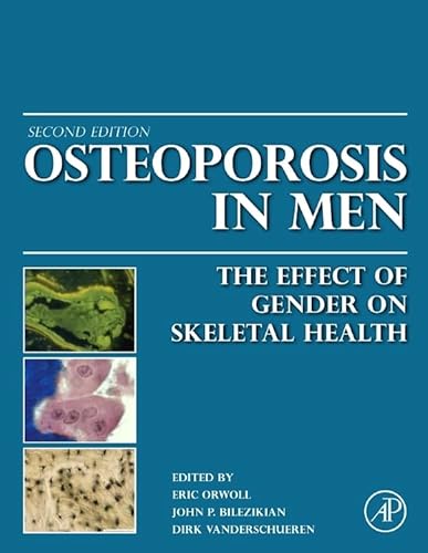 technical/general/osteoprorsis-in-men-the-effects-of-gender-on-skeletal-health-hb--9780123746023