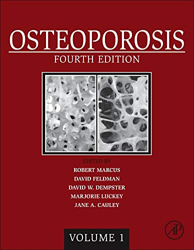 medical/orthopaedics/osteoporosis-2-vols-set-9780124158535
