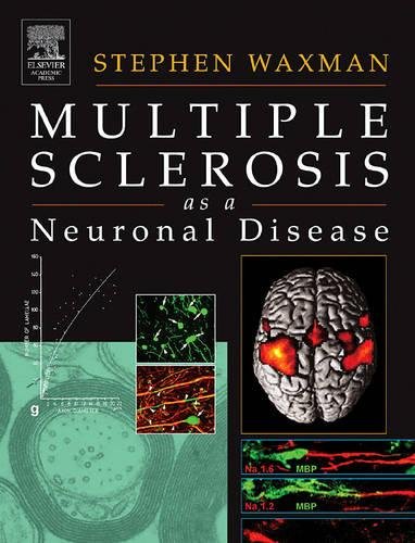 medical/neurology/multiple-sclerosis-as-a-neuronal-disease-9780127387611