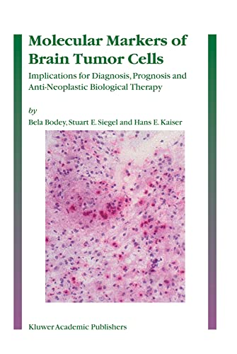 medical/neurology/molecular-markers-of-brain-tumor-cells-9781402027819