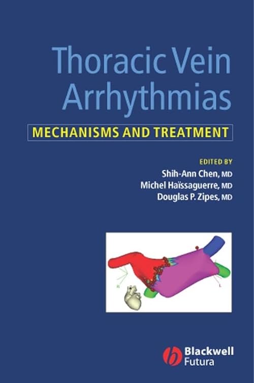 medical/cardiology/thoracic-vein-arrhythmias---mechanisms-and-treatment-9781405118880