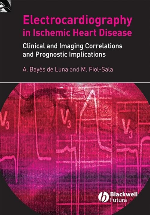 medical/cardiology/electrocardiography-in-ischemic-heart-disease-clinical-imaging-correlations-prognostic-implications-9781405173629