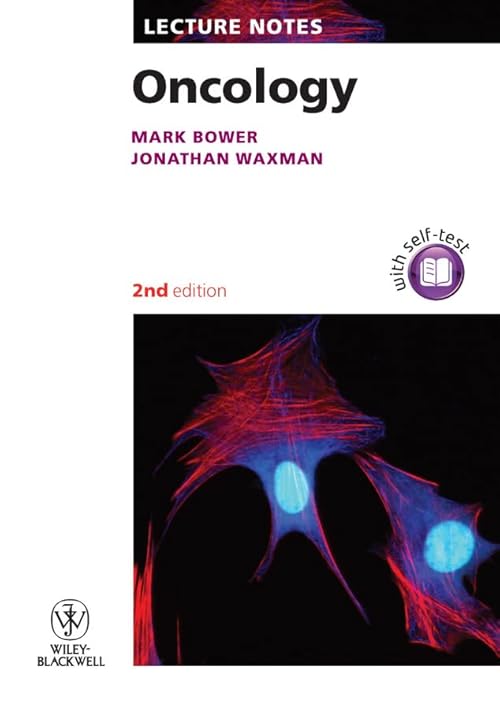 medical/oncology/lecture-notes-oncology-2e-pb--9781405195133