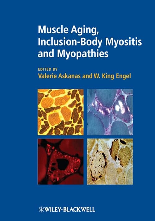 technical/general/muscle-aging-inclusion-body-myositis-and-myopathies-9781405196468
