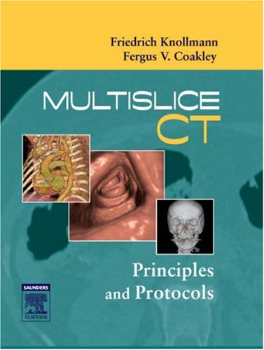 MULTISLICE CT:PRINCIPLES AND PROTOCOLS medical/radiology/multislice-ct-principles-and-protocols-9781416002680