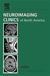 medical/ophthalmology/ophthalmologic-imaging-an-issue-of-neuroimaging-clinics-volume-15-1-1-ed-9781416027324