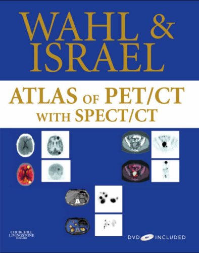 medical/radiology/atlas-of-pet-ct-with-spect-ct-dvd-included-9781416033615