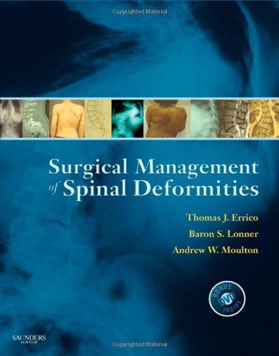 medical/orthopaedics/surgical-management-of-spinal-deformities-expert-consult-online-and-print-9781416033721