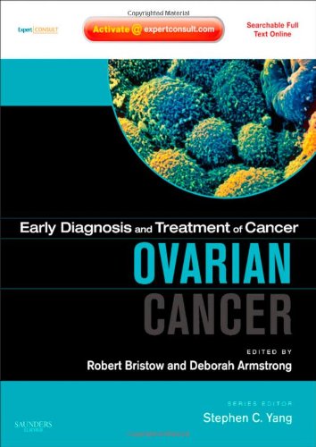 medical//early-diagnosis-and-treatment-of-cancer-ovarian-cancer-9781416046851