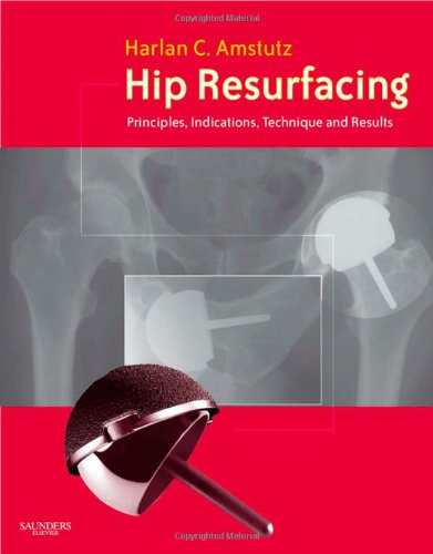 medical/orthopaedics/hip-resurfacing-principles-indications-technique-and-results-9781416047247