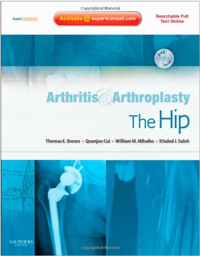 medical/orthopaedics/arthritis-and-arthroplasty-the-hip-expert-consult---online-print-and-dvd-9781416049739