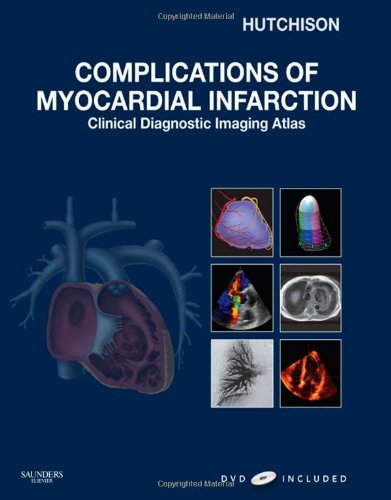 medical/cardiology/complications-of-myocardial-infarction-clinical-diagnostic-imaging-atlas-with-dvd-9781416052722