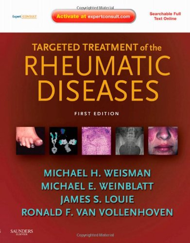 medical/general-medicine/targeted-treatment-of-the-rheumatic-diseases-expert-consult---online-and-print-9781416099932