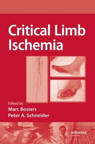 medical/cardiology/critical-limb-ischemia-9781420081893