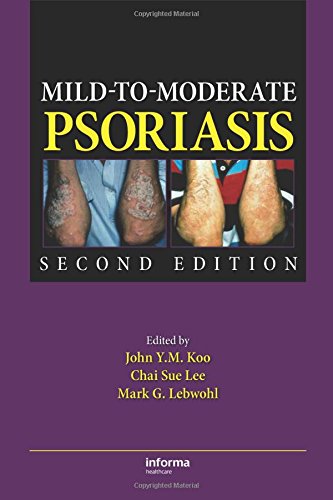medical/forensic-medicine/mild-to-moderate-psoriasis-9781420088601