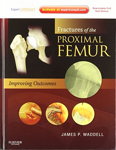 technical/general/fractures-of-the-proximal-femur-improving-outcomes-9781437706956