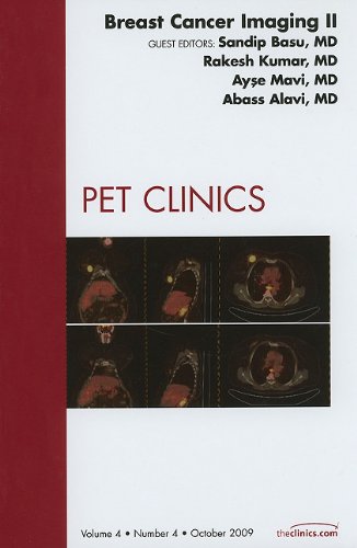 BREAST CANCER IMAGING II, AN ISSUE OF PET CLINICS,1 medical/radiology/breast-cancer-imaging-ii-an-issue-of-pet-clinics-1-9781437714029