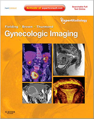 medical//gynecologic-imaging-expert-radiology-series-9781437715750