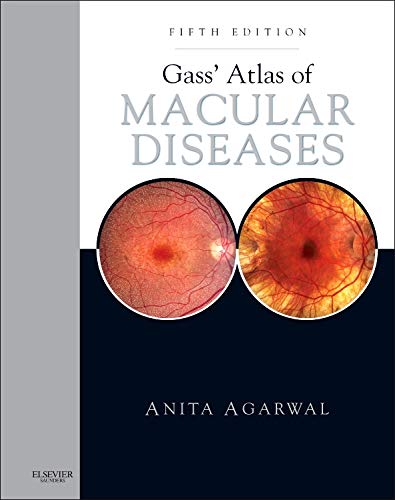 medical/ophthalmology/gass-atlas-of-macular-diseases-5-ed-2-vols-9781437715804