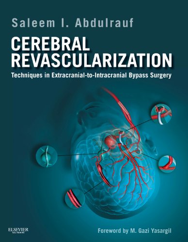 medical/neurology/cerebral-revascularization-techniques-in-extracranial-to-intracranial-bypass-surgery-9781437717853