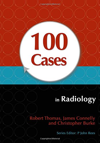 100 CASES IN RADIOLOGY medical/radiology/100-cases-in-radiology-9781444123319