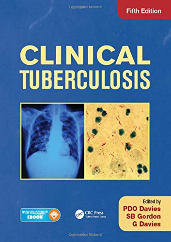 medical/respiratory-medicine/clinical-tuberculosis-5ed-excl-abc--9781444154344