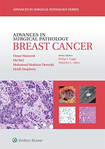 medical/pathology/advances-in-surgical-pathology-breast-cancer-9781451191714