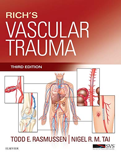 medical/cardiac-surgery/rich-s-vascular-trauma-9781455712618