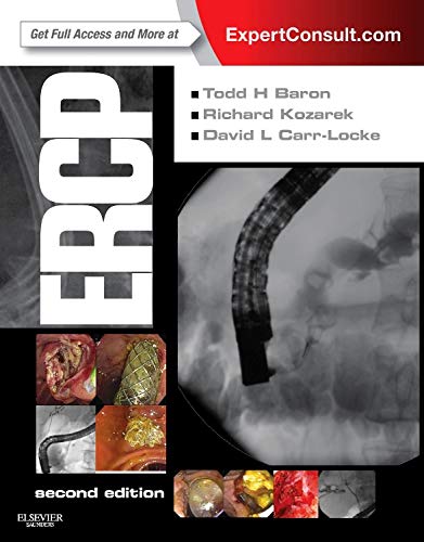ERCP: EXPERT CONSULT medical/medicine/ercp-expert-consult-9781455723676