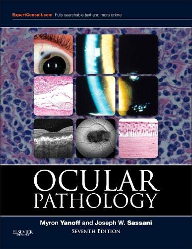 medical/pathology/ocular-pathology-9781455728749