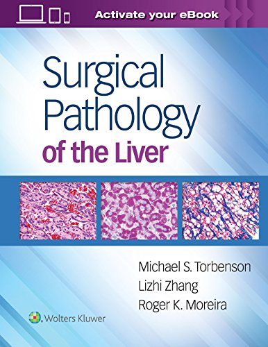 medical/pathology/surgical-pathology-of-the-liver-9781496365798
