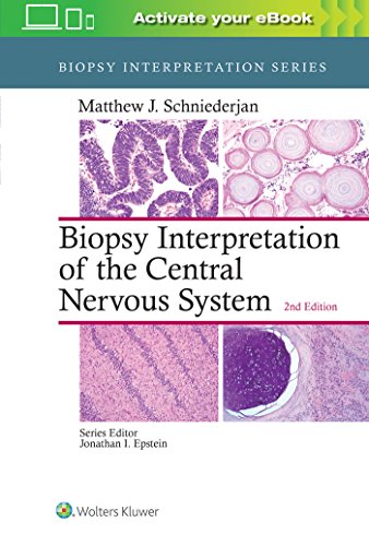 medical/pathology/biopsy-interpretation-of-the-central-nervous-system-9781496382634