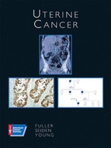 medical/oncology/uterine-cancer-with-cd-rom-9781550091632