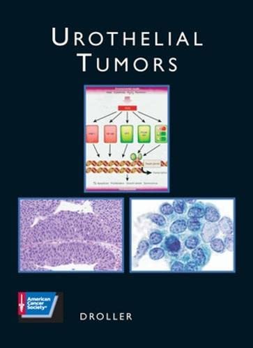 medical/urology/urothelial-tumors-with-cd-rom-9781550091731