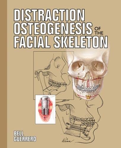 medical/plastic-surgery/distraction-osteogenesis-of-the-facial-skeleton-with-cd-9781550093445