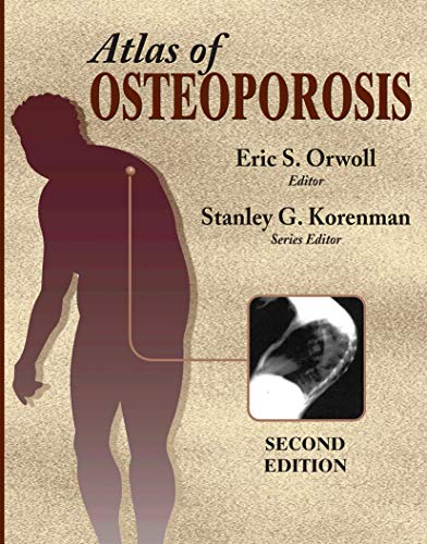 technical/general/atlas-of-osteoporosis-9781573401982