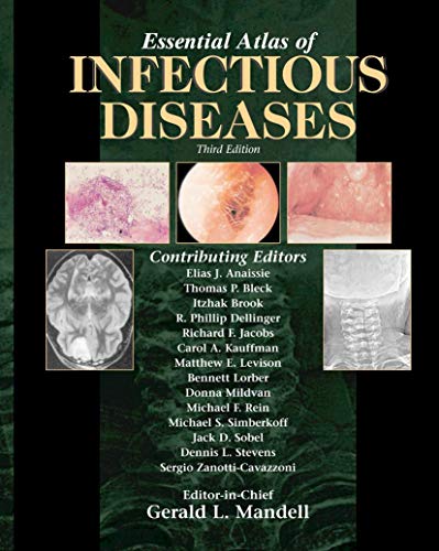 ESSENTIAL ATLAS OF INFECTIOUS DISEASES, 3ED. medical/microbiology/essential-atlas-of-infectious-diseases-3ed--9781573402095